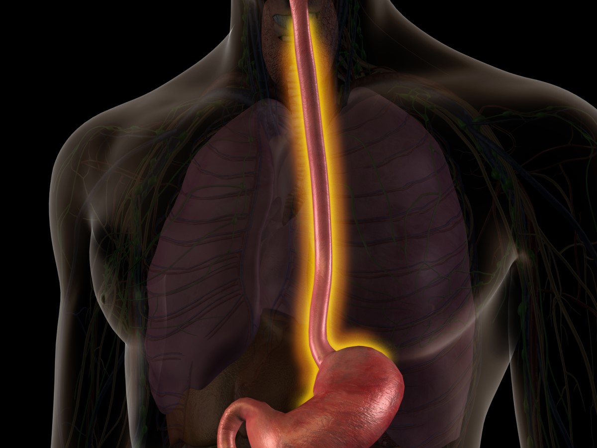 Anatomické zobrazení jícnu - oranžově zvýrazněná trávicí trubice. ezofagus