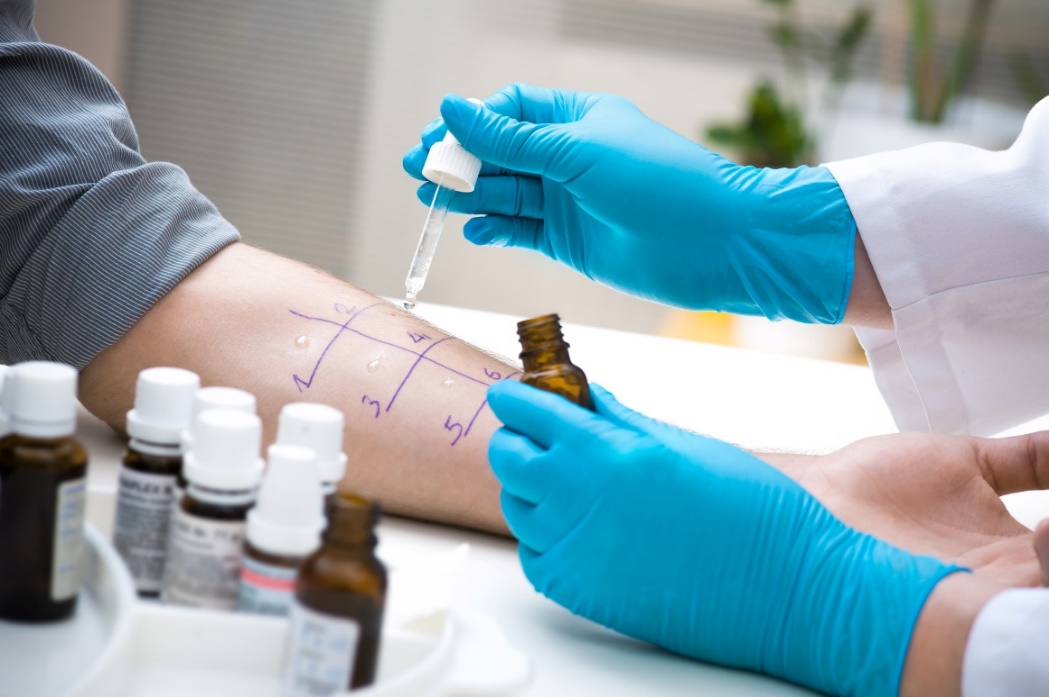 Kožní diagnostický alergenový test