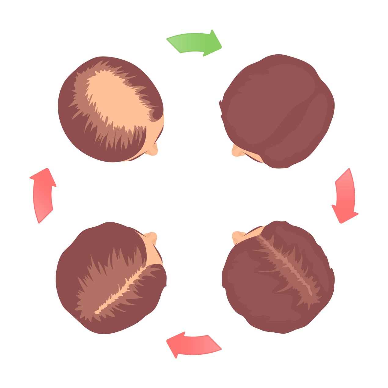 Cyklus vypadávání vlasů