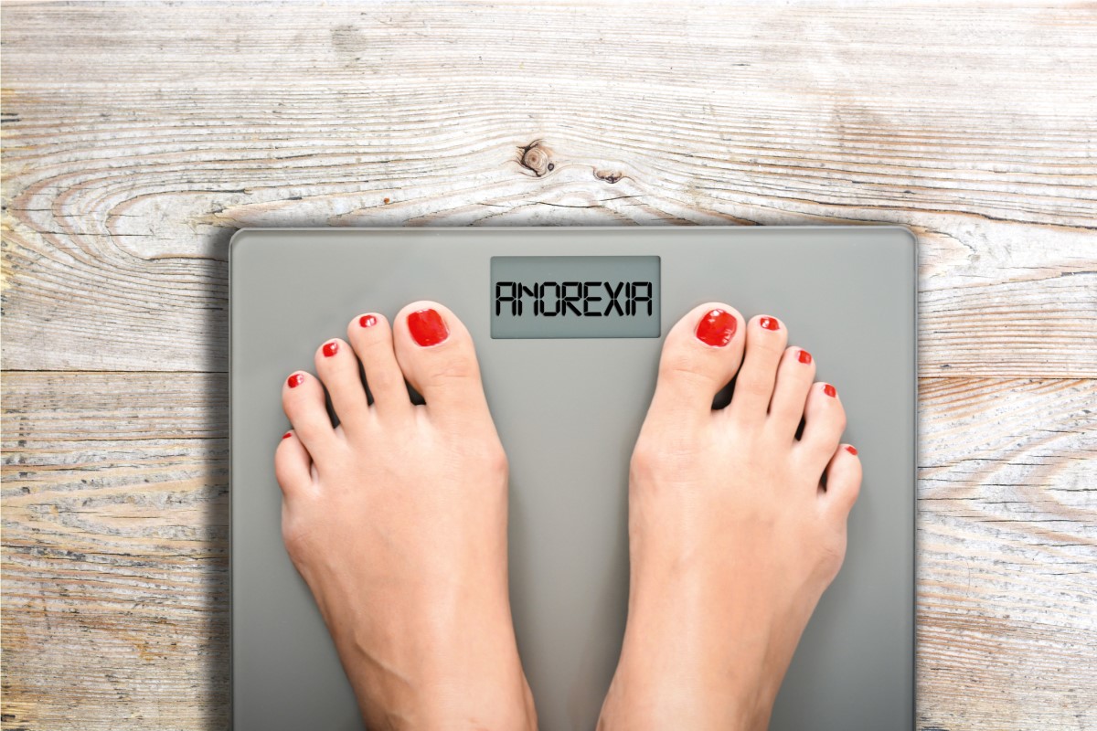 Anorexie je představa o vlastní vysoké hmotnosti, která neodpovídá skutečnosti. Dotyčný si neuvědomuje ohrožení vlastního zdraví a života. Nohy na váze s nápisem anorexie.