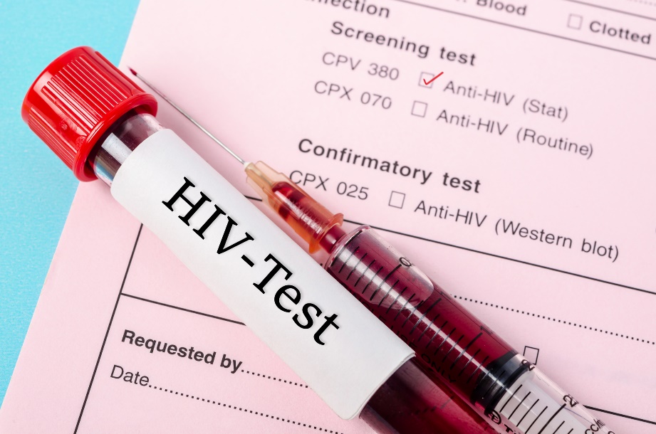 Diagnostický test na přítomnost anti-HIV protilátek v krevním vzorku pacienta