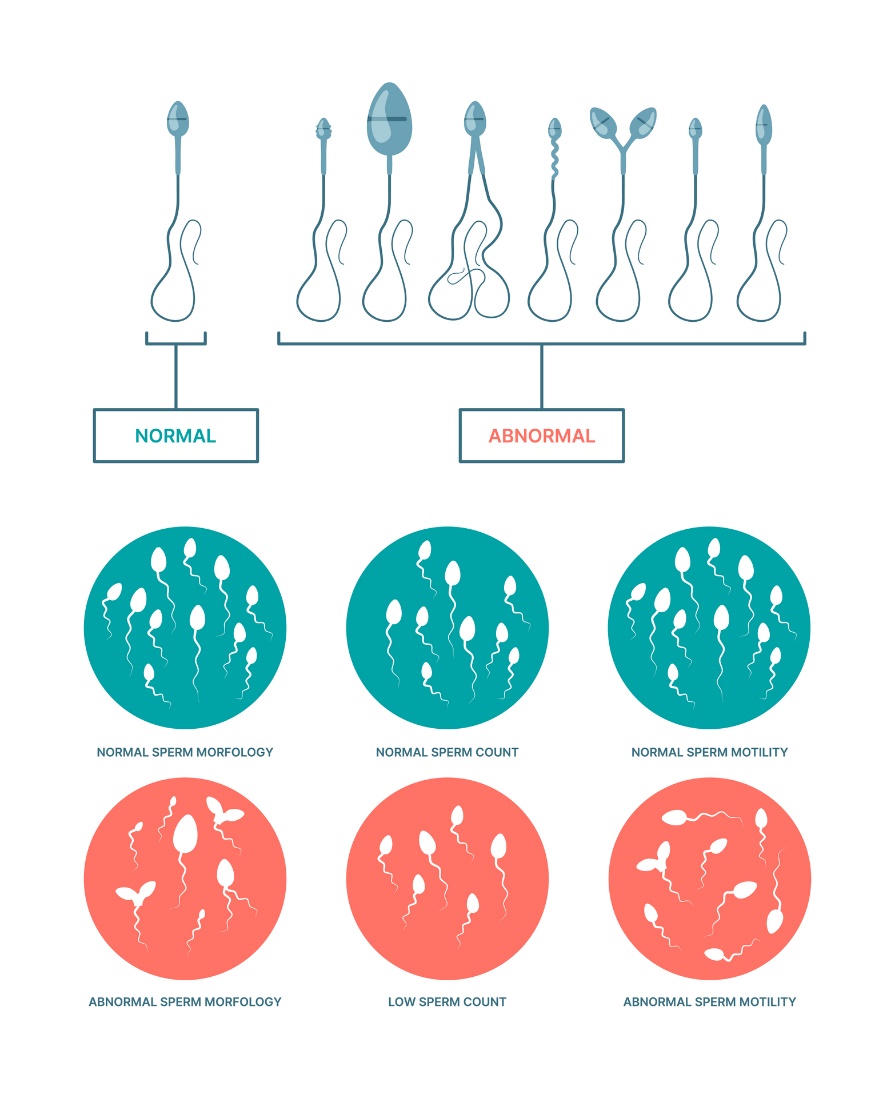 Fyziologický a abnormální stav spermií. Morfologie, počet a pohyblivost spermií