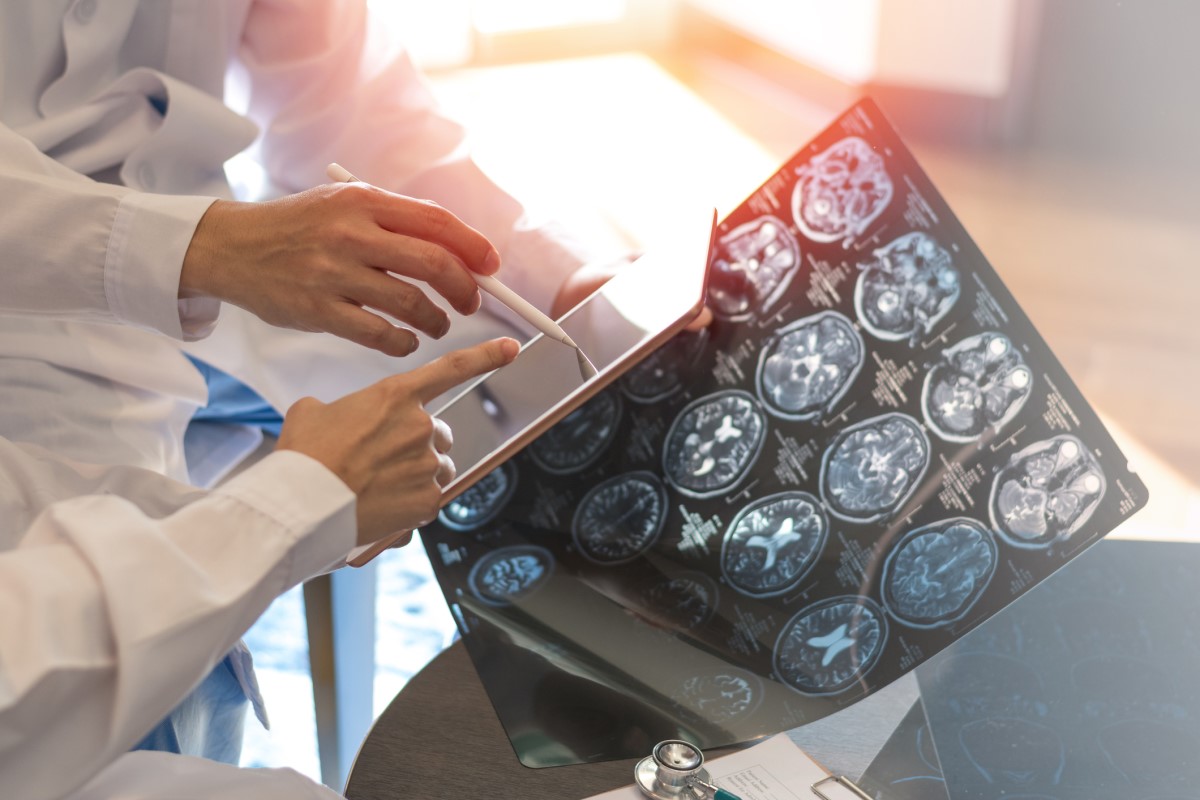 Skenování mozku, jako základ vyšetření, lékař drží snímky v jedné ruce, v druhé drží tablet, posuzuje stav.