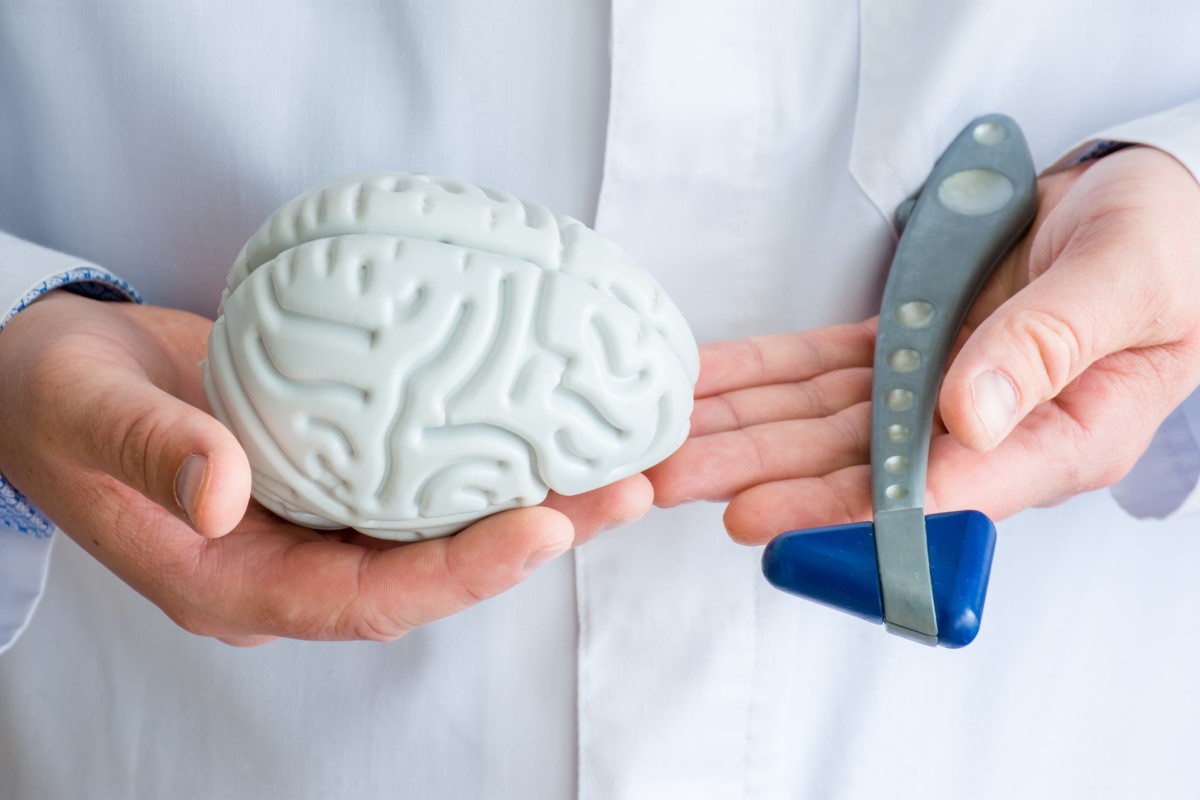 Vyšetření neurologem, lékař má v ruce model mozku a neurologické vyšetření kladívkem.