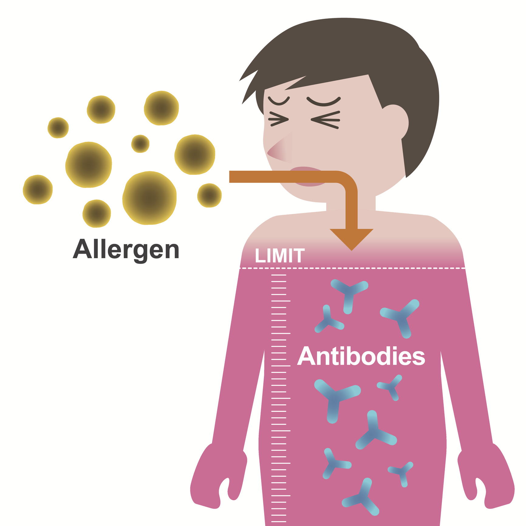 Mechanismus vzniku alergie