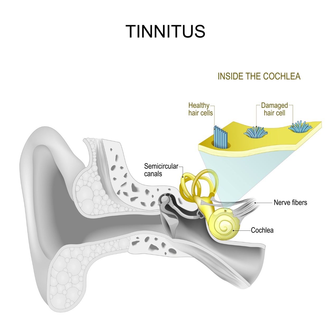 Vnitřní ucho a tinnitus - pískání a hučení v uchu
