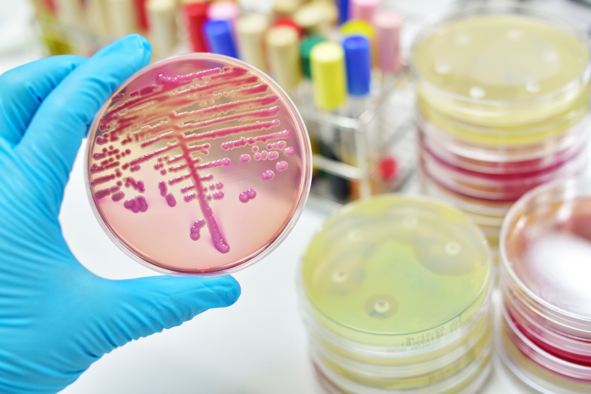 Mikrobiologické vyšetření - kultivace - bakteriální kolonie