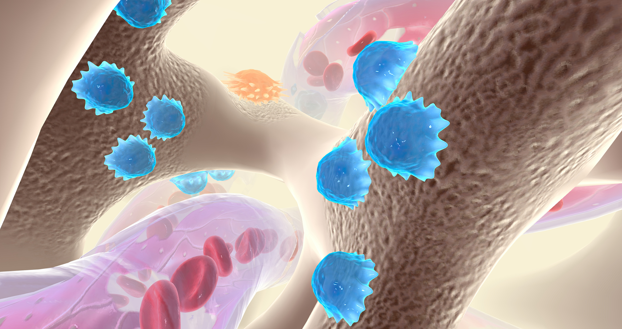 Myelomové buňky. Zdrojové foto: Getty Images Myelomové buňky