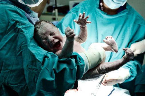 Plačící novorozenec v rukou lékaře těsně po sekci