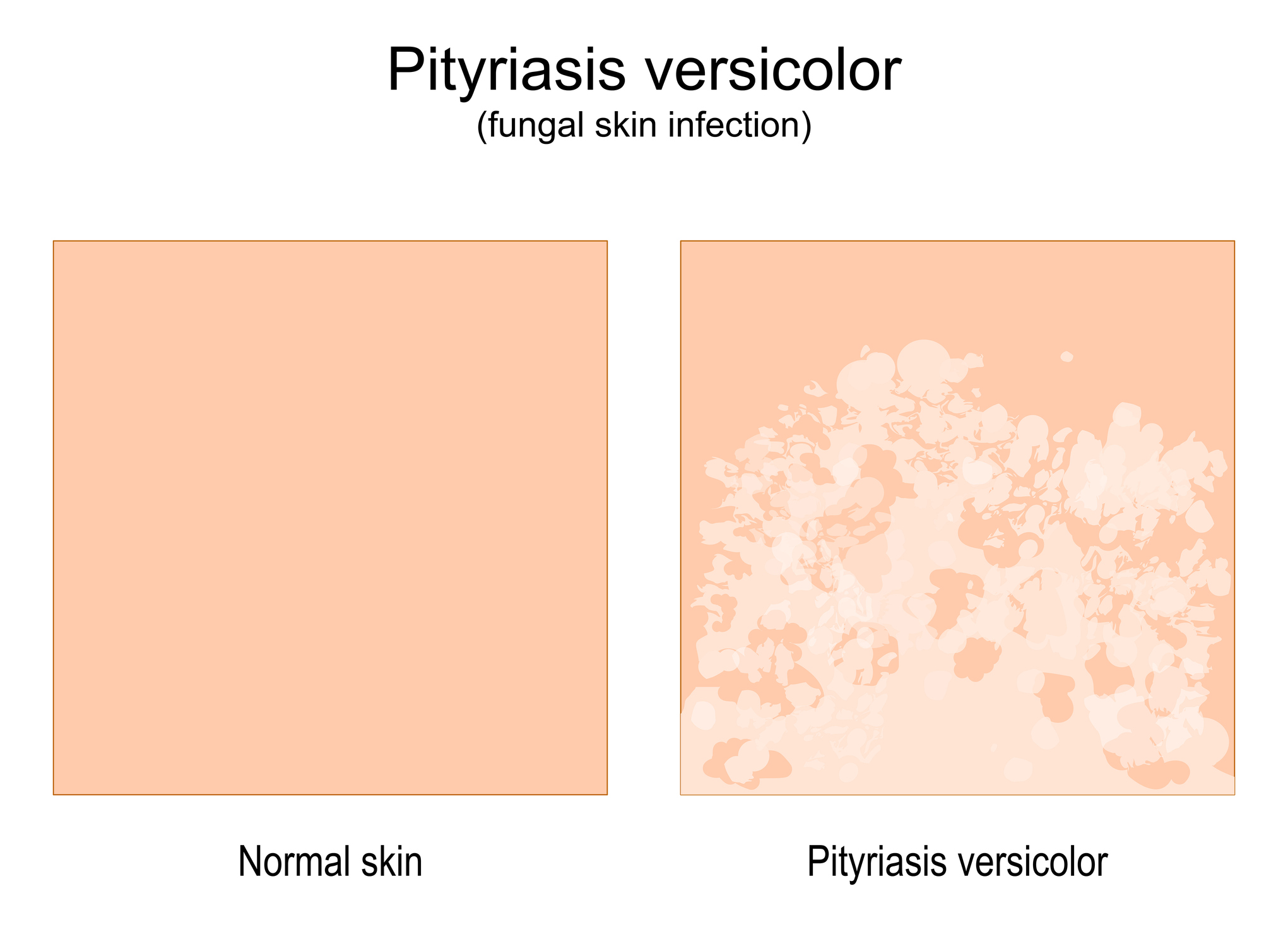Srovnání normální kůže a kůže se známkami onemocnění