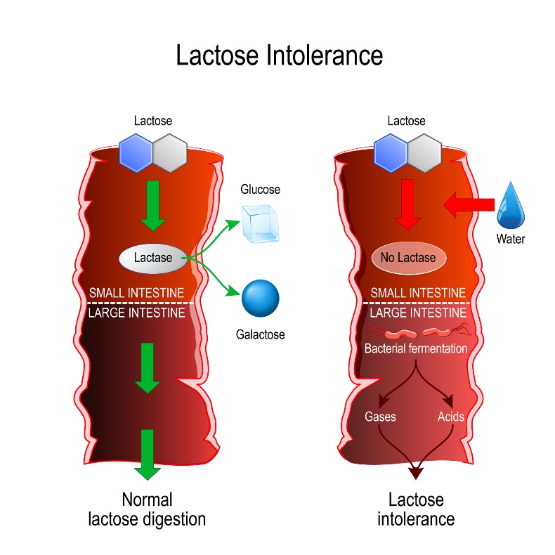 Porovnání fyziologického trávení a laktózové intolerance