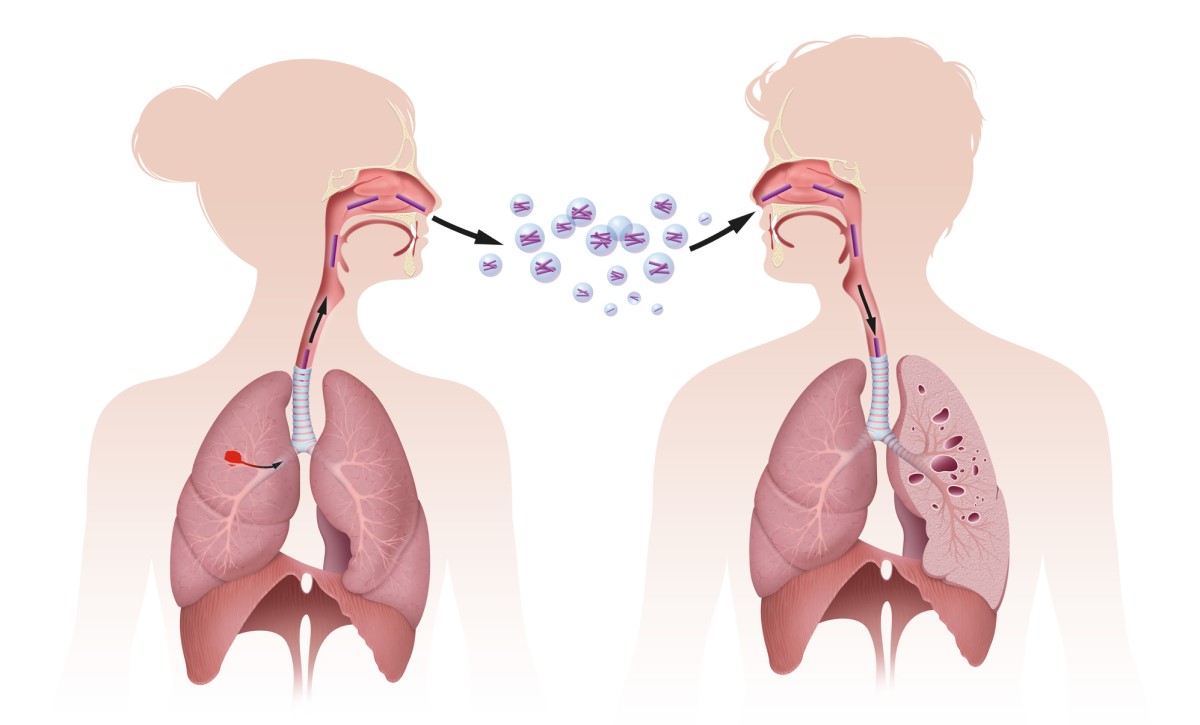 Přenos TBC inhalací, tj. vdechnutím, obrázek ukazuje přenos inhalací.