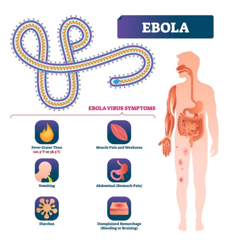 Příznaky eboly