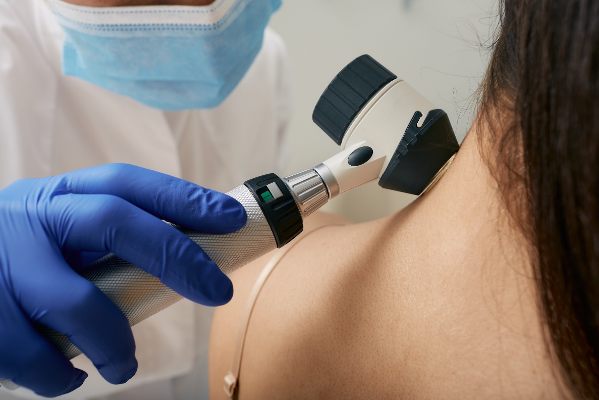 Lékařské vyšetření kožních útvarů dermaskopem