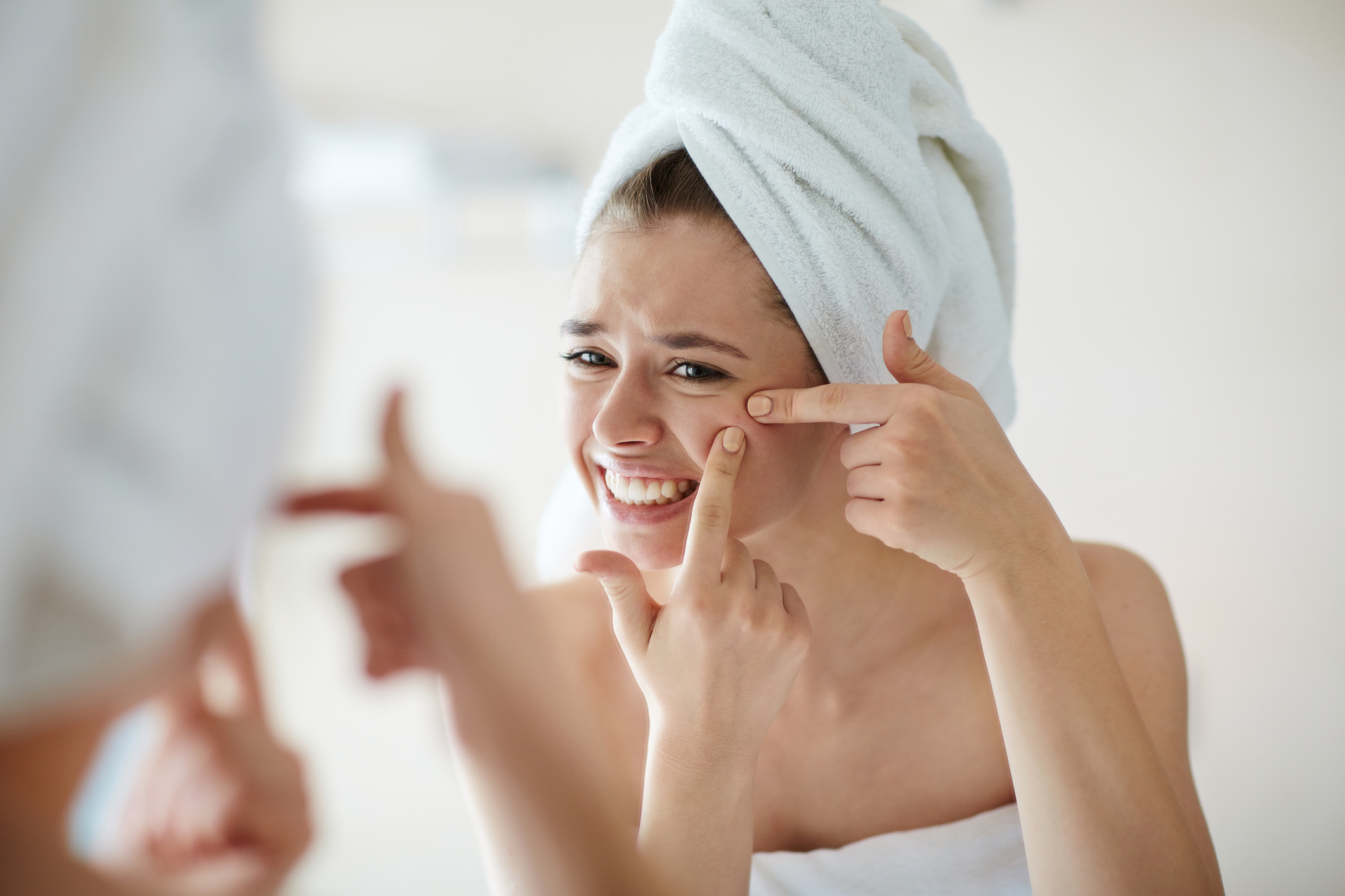 Žena s akné na tváři, vytlačuje si pupínky, má ručník na vlasech