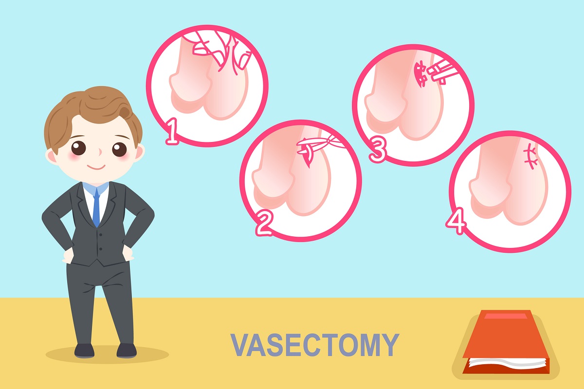 Vasektomie