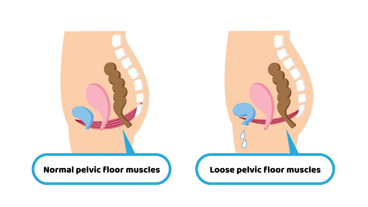 Fyziologie svalů pánevního dna a oslabení svalů pánevního dna