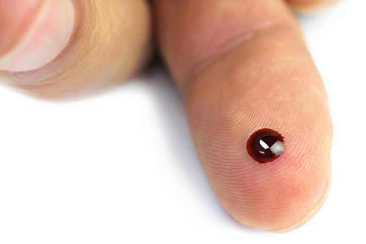 Glykémie - kapka krve na bríšku prstu po vpichu jehlou k merení cukru v krvi