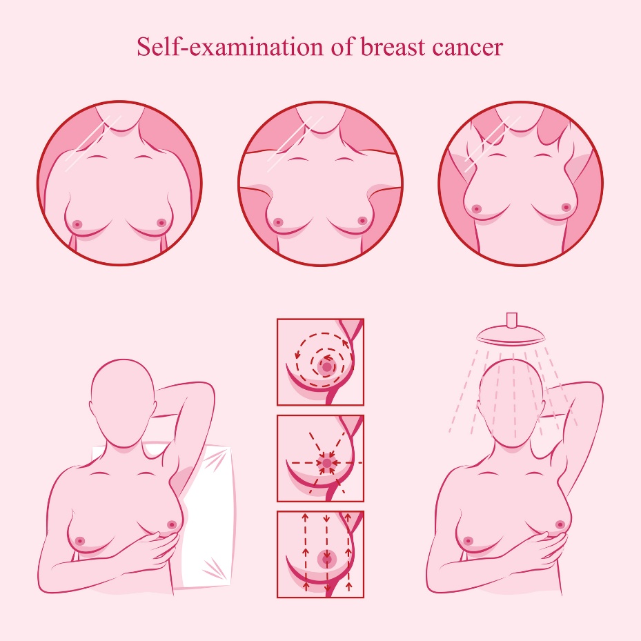 Ilustrace samovyšetření prsou