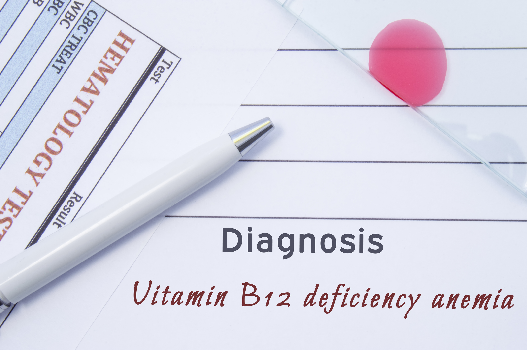 Nedostatek vitaminu B12 může způsobit perniciózní anémii.