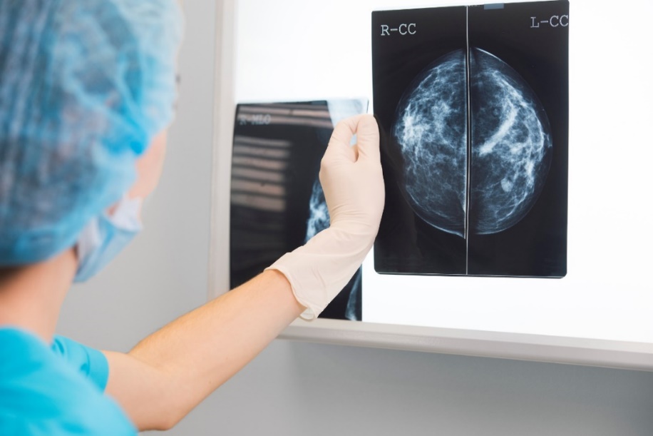 Mamografický snímek prsu
