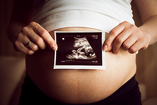 Těhotná žena drží sono s obrázkem děťátka