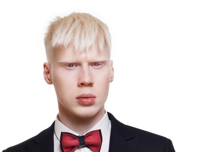 mladý muž albín, bílé vlasy, v saku