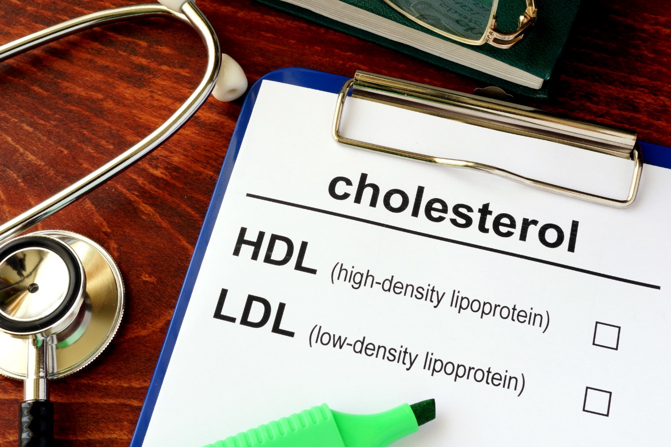 Vyšetření HDL a LDL cholesterolu. Zdroj fotografií: Getty Images Zvýšená hladina cholesterolu - screening HDL a LDL cholesterolu. pro krevní test