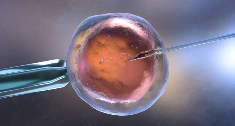 In vitro fertilizace IVF. Zdroj: Getty Images