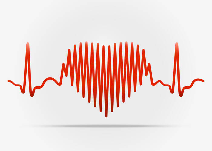 Arytmie: Co je to srdeční arytmie a jak se projevuje? + Léčba
