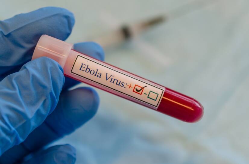 Ebola: Jaké jsou příznaky?