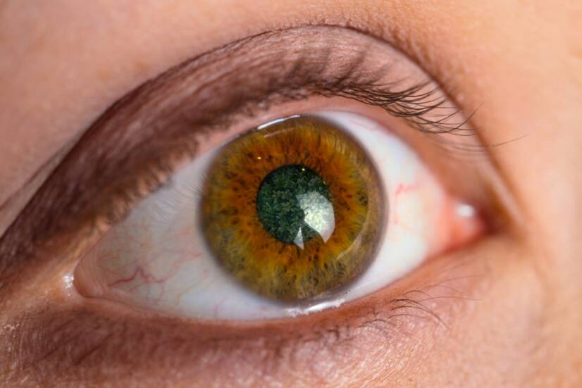 Glaukom či zelený zákal: Jaké má příčiny, příznaky a léčbu?