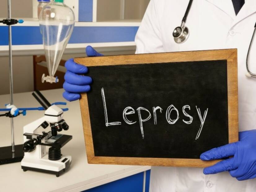 Lepra: Co je malomocenství, jak vzniká a jaké jsou jeho příznaky?