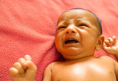 Kdy je novorozenecká žloutenka nebezpečná? Co je a proč vzniká ikterus u novorozenců?