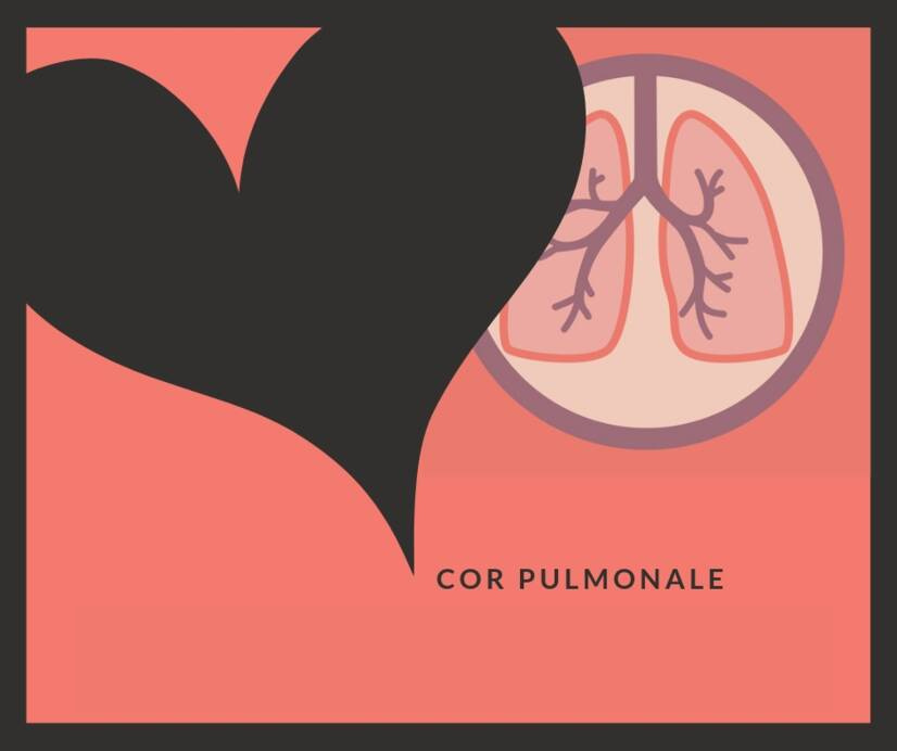 Plicní srdce: Co je to cor pulmonale, proč vzniká a jak se projevuje?