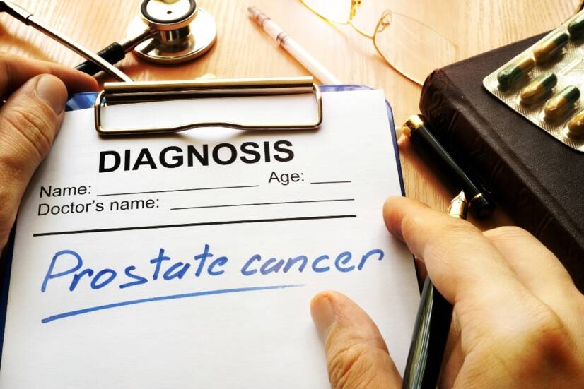 Rakovina prostaty: Příčiny a první příznaky. Jaká je prognóza léčby?