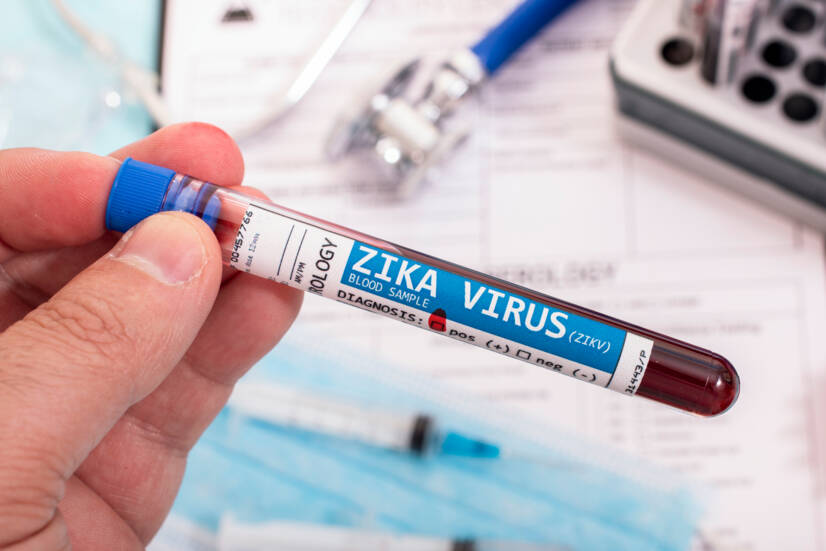 Virus zika: co je to, jak se přenáší a jaké jsou příznaky? Riziko v těhotenství