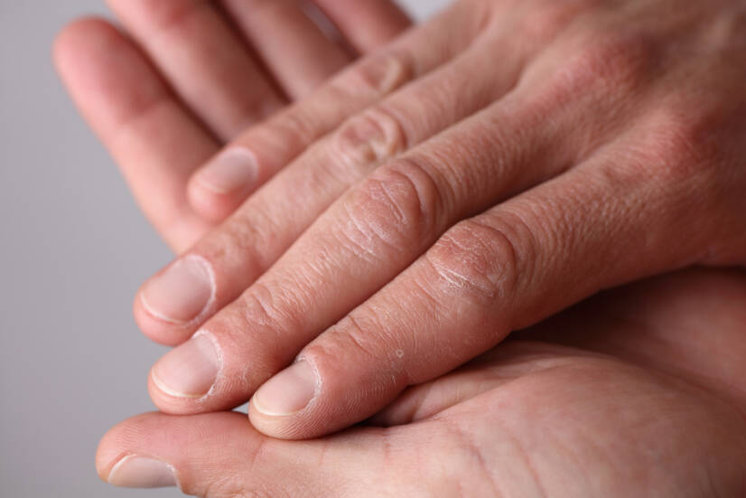 Jak pečovat o ruce? 3 kroky: mytí, dezinfekce, krémování