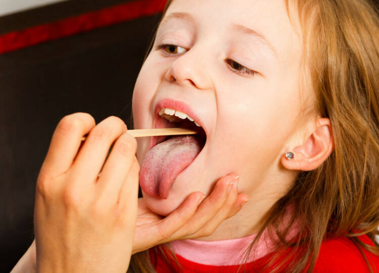 Správná lécba angíny u detí? Jaké má príciny a príznaky?