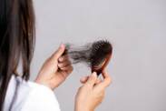 Alopecie (stav sníženého množství vlasů): Jaké má příčiny a příznaky?