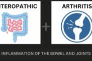Enteropatická artritida a zánět střeva: Jak spolu souvisí? + Příznaky