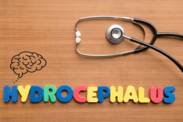 Hydrocefalus: Co to je a proč vzniká? Jaké jsou příznaky a následky?