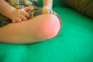 Juvenilní idiopatická artritida: Příznaky revma, zánětu kloubů u dětí?