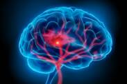 Krvácení do mozku: proč k němu dochází a jaké jsou jeho příznaky?