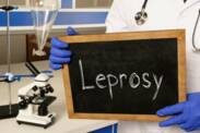 Lepra: Co je malomocenství, jak vzniká a jaké jsou jeho příznaky?