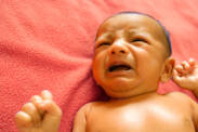 Kdy je novorozenecká žloutenka nebezpečná? Co je a proč vzniká ikterus u novorozenců?