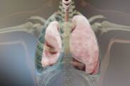 Pneumotorax (vzduch v hrudníku): Příčiny, příznaky a první pomoc