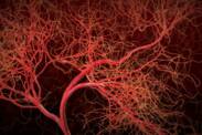 Co jsou vaskulitidy a co je příčinou zanícených cév? + Příznaky, léčba