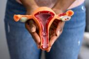 Co je konizace děložního čípku a jak probíhá? Rekonvalescence a těhotenství