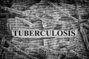 Tuberkulóza nepatří do minulosti, ročně zabíjí miliony lidí